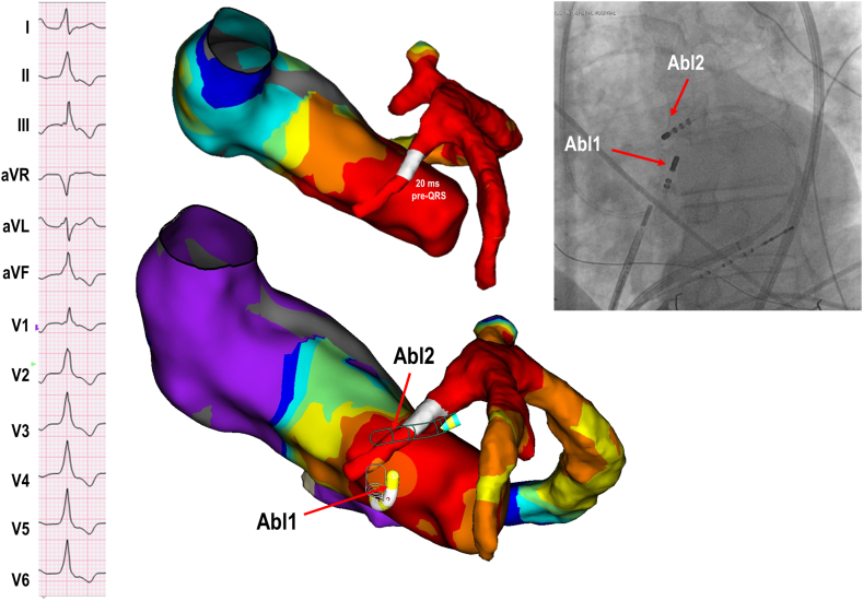 Figure 4