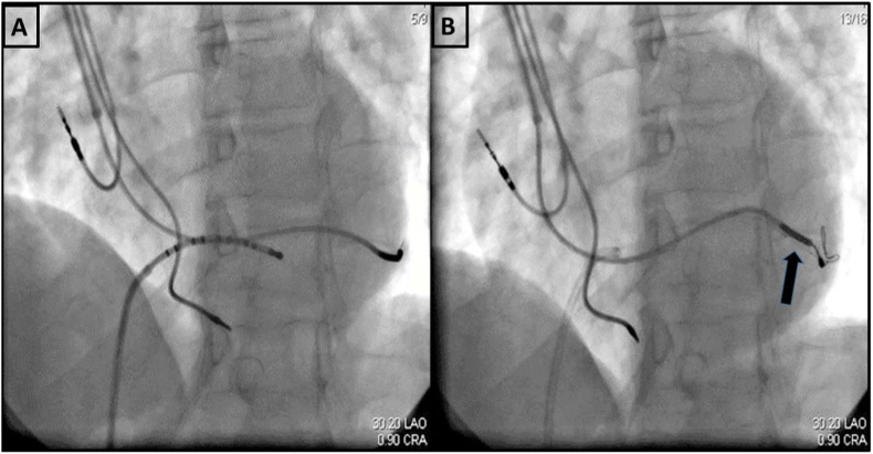 Fig. 1