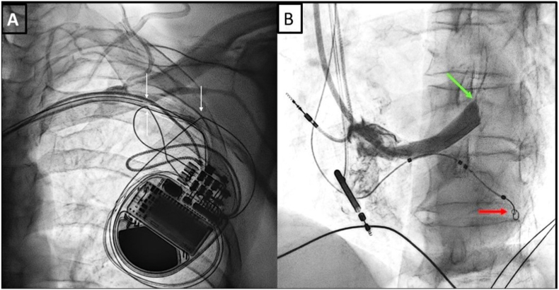 Fig. 3