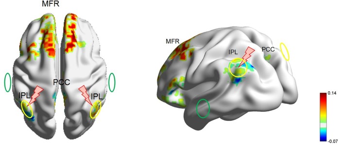 FIGURE 3