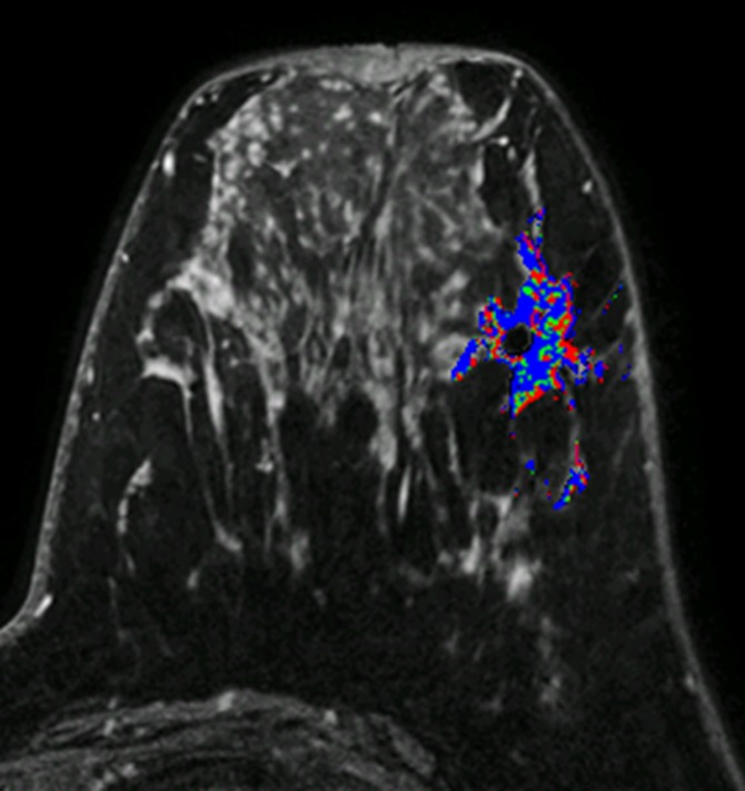 Figure 3b: