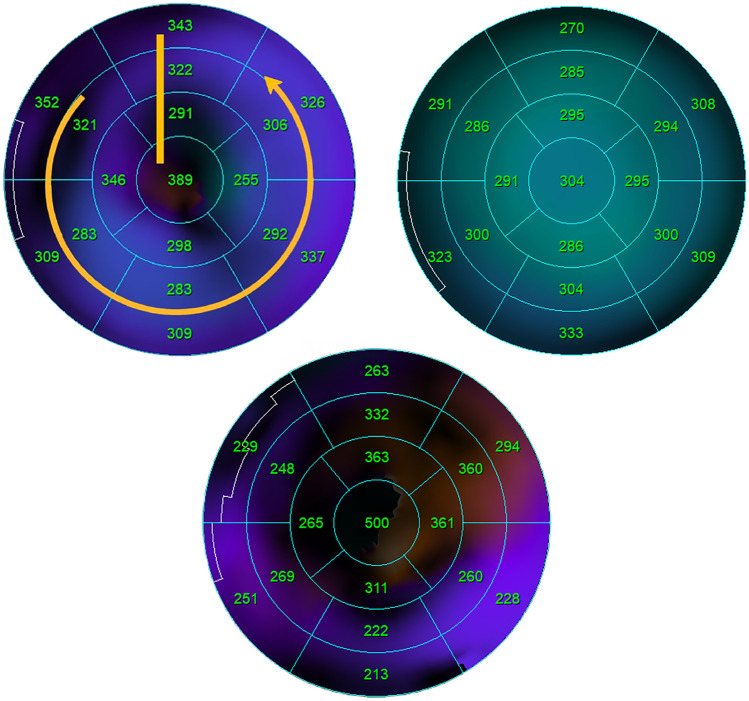 Fig. 2