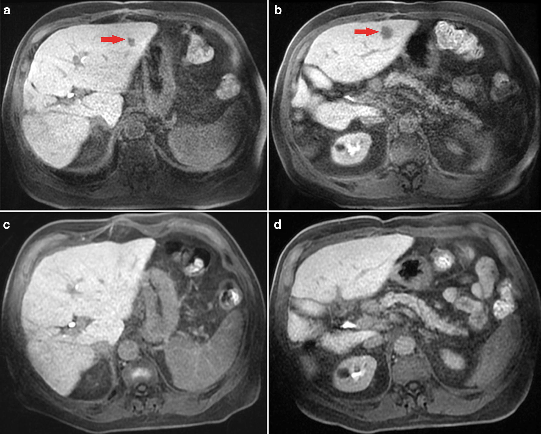 Fig. 1