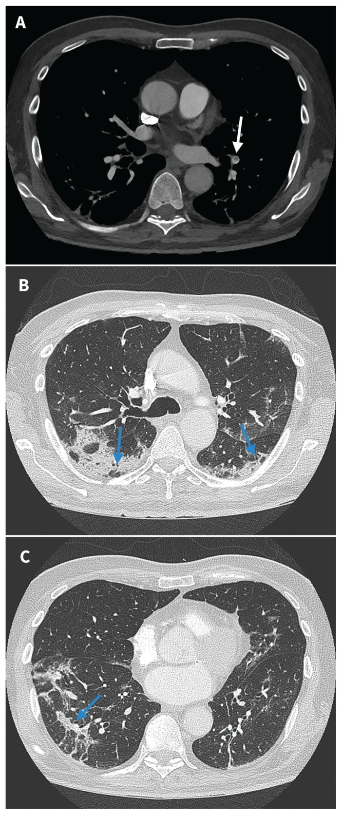 Figure 2: