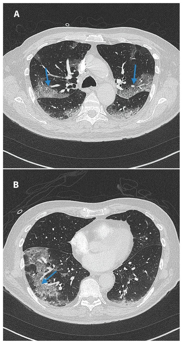 Figure 1: