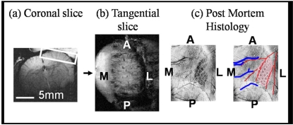 Fig. (1)