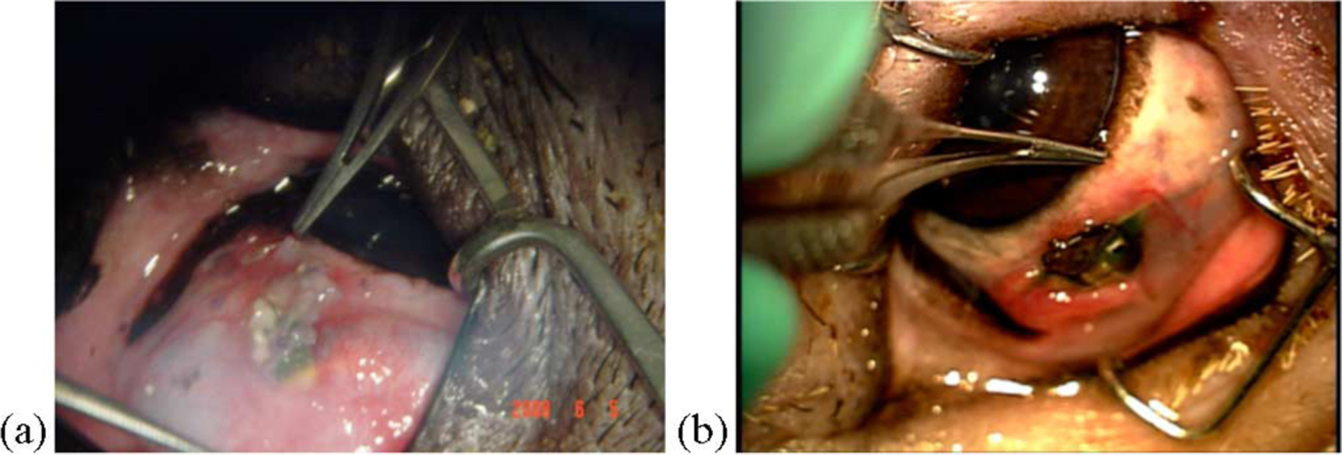 Fig. 13.