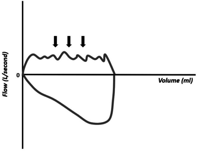 Figure 18.