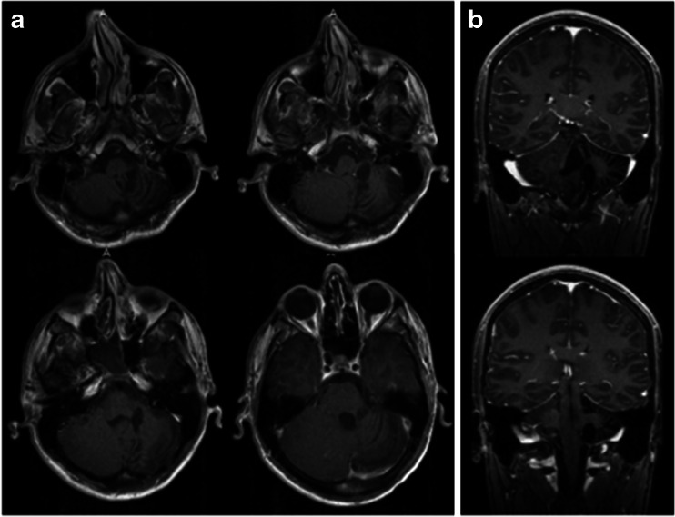 Fig. 14