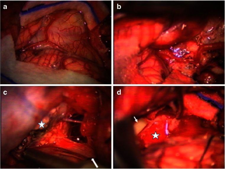 Fig. 13