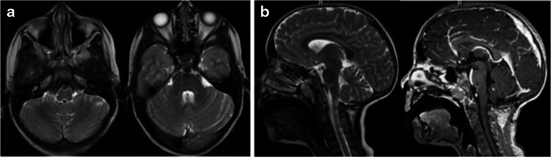 Fig. 11