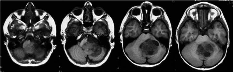 Fig. 12