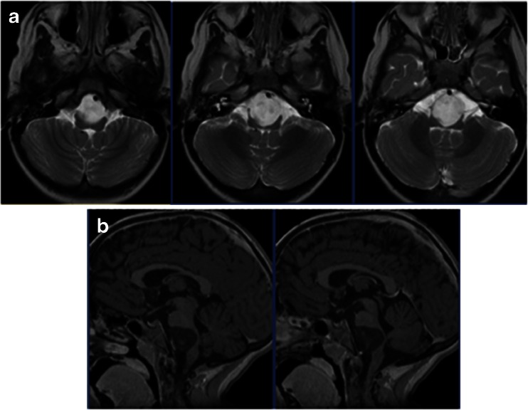 Fig. 9