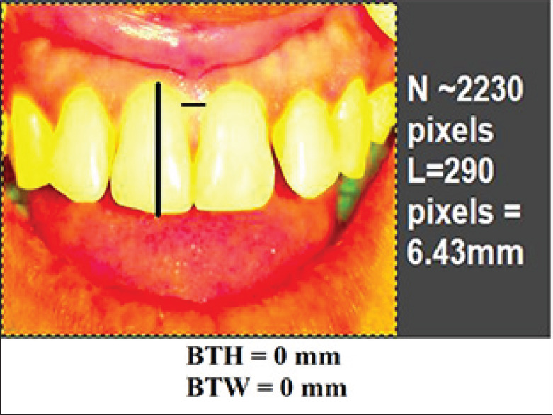 Figure 12