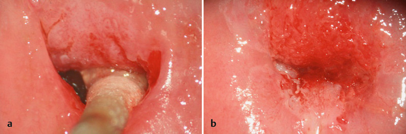 Fig. 3 a