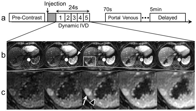 FIG 2