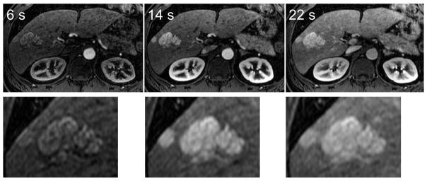 FIG 3