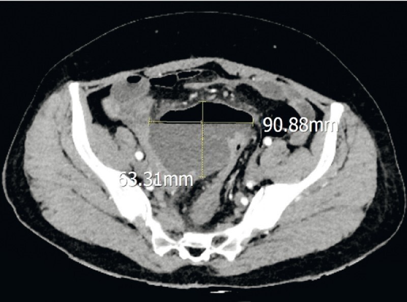 Fig. 1