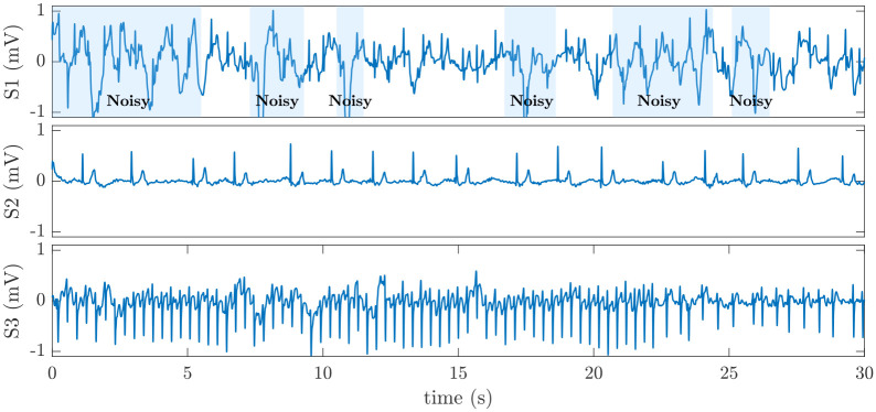 Fig 3