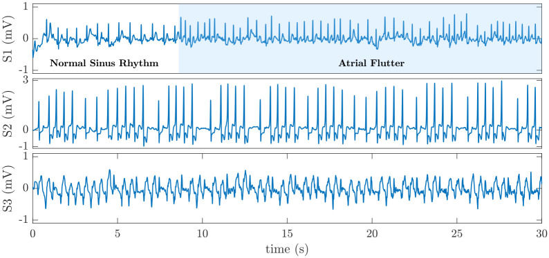 Fig 4