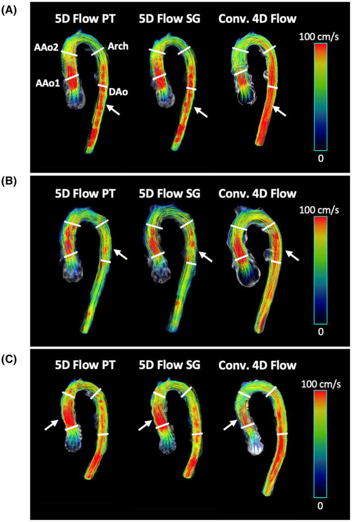Pilot tone navigation for respiratory and cardiac motion‐resolved free ...