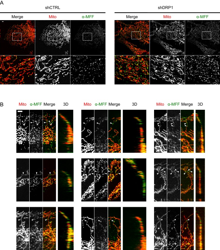 Figure 5—figure supplement 1.