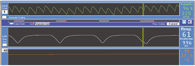 Figure 2: