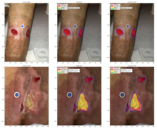 Figure 11