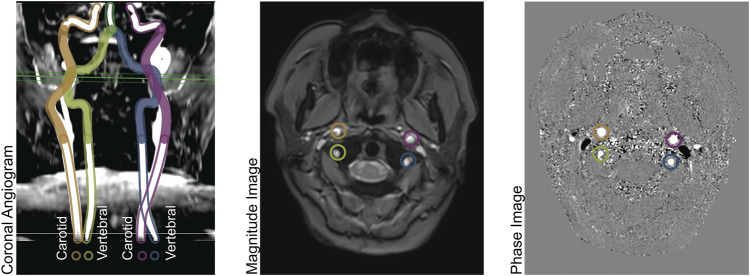 FIGURE 1