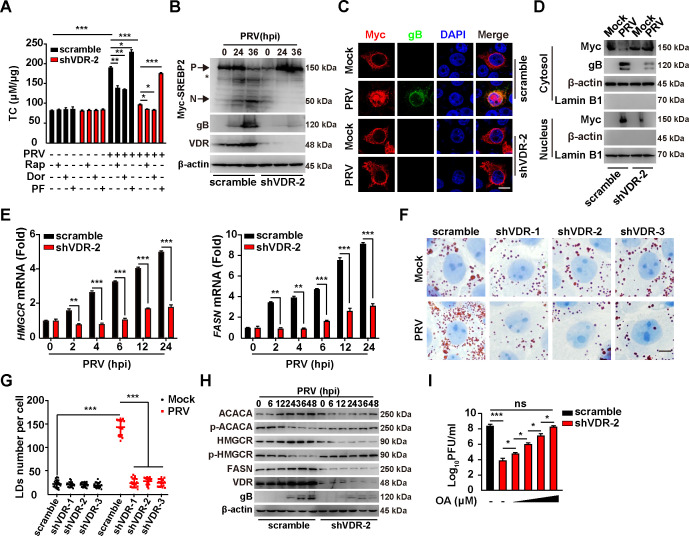 Bar graphs, western blots, and micrographs show the impact of VDR knockdown on lipid metabolism genes, PRV infection, lipid droplet formation, and viral proliferation under various treatments.