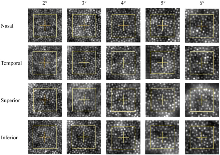 Fig 2