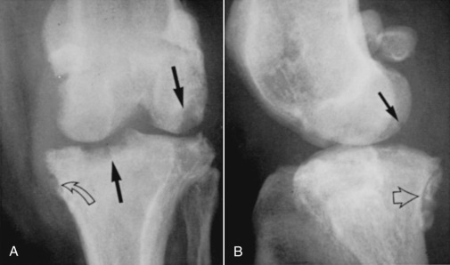 Fig. 21.52