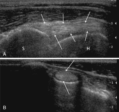 Fig. 21.41