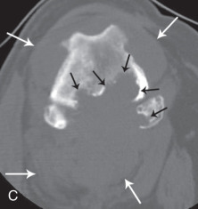 Fig. 21.62