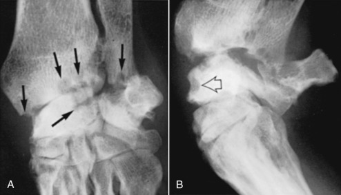 Fig. 21.53