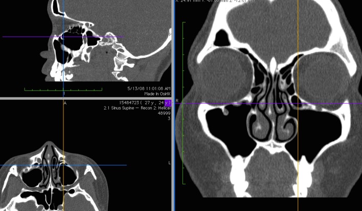 Fig. 4