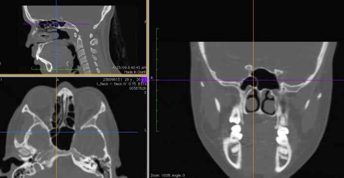 Fig. 6