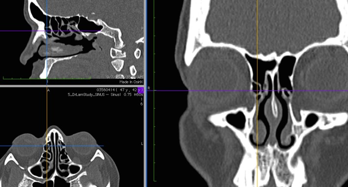 Fig. 3