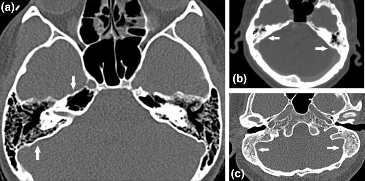 Fig. 1