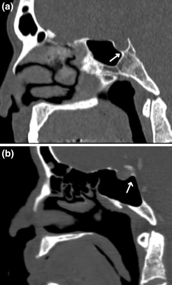 Fig. 2