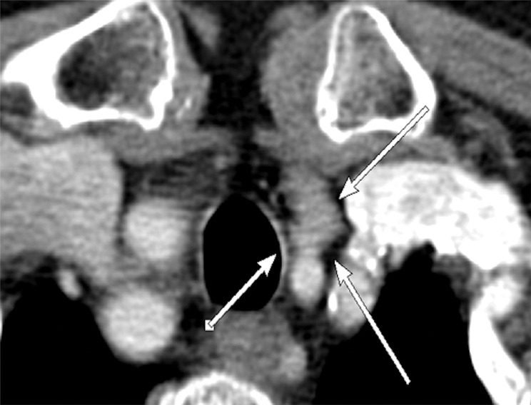 Figure 5b: