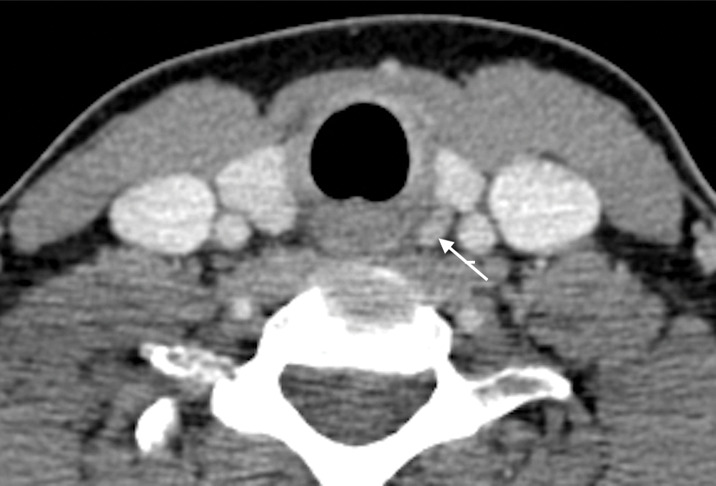 Figure 4a: