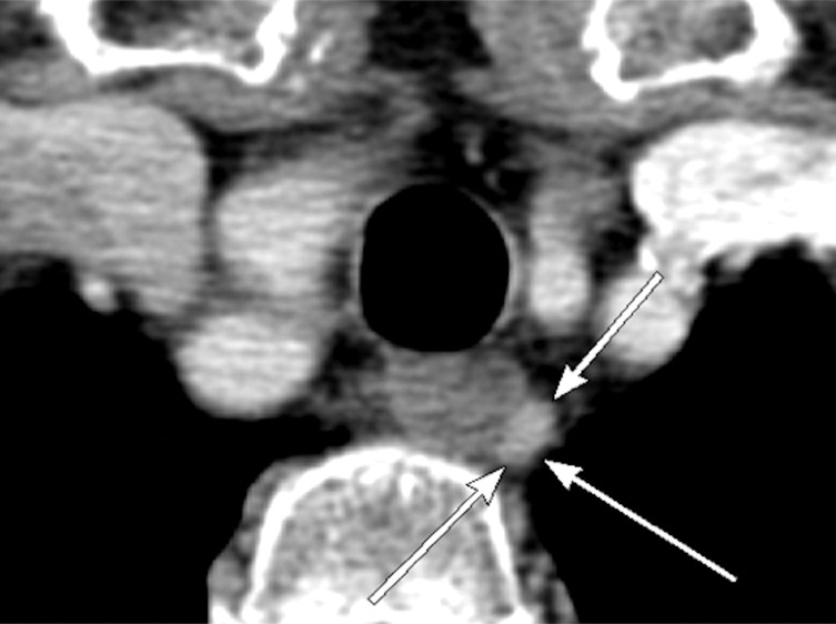 Figure 5d: