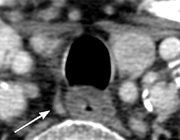 Figure 5c: