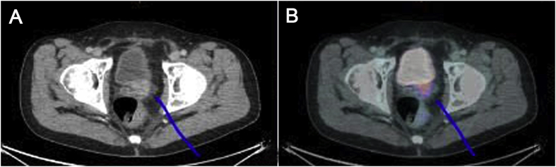 Figure 2