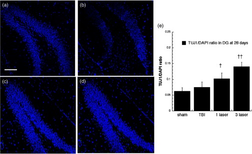 Fig. 15