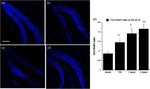 Fig. 14