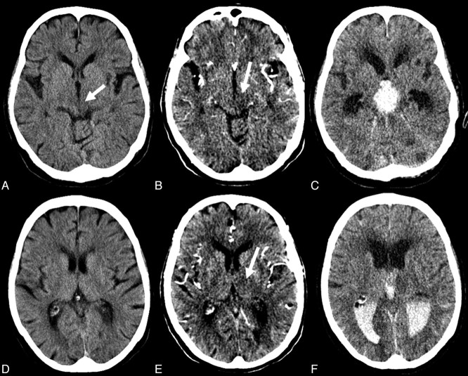 Fig 3.