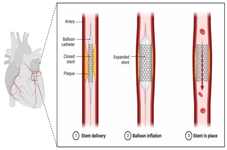 Figure 15