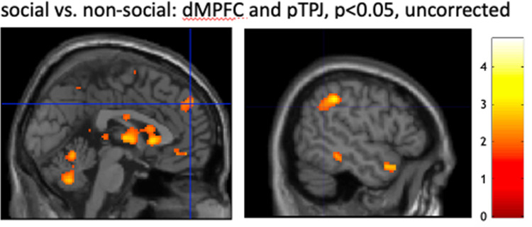 Figure 4—figure supplement 3.